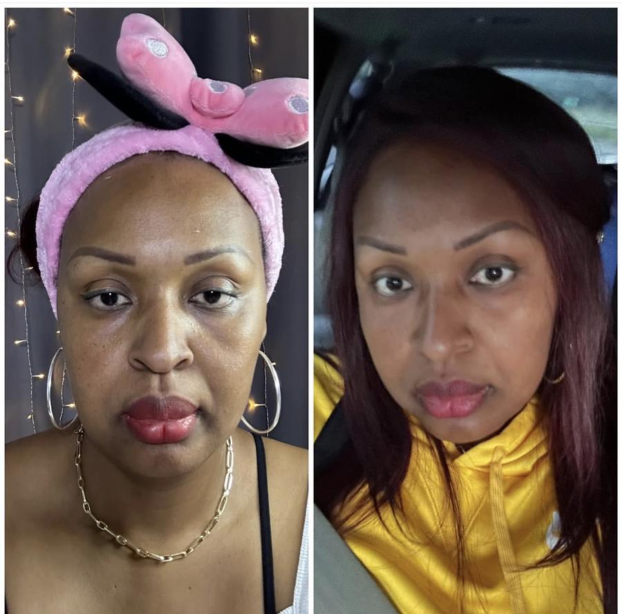 Brightening facial before and after